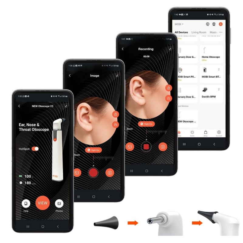 20-Piece Speculum Set for Use with MOBI Smart Bluetooth Otoscope - Professional Grade Accessories for Ear, Nose, and Throat Examination, Black - BeesActive Australia