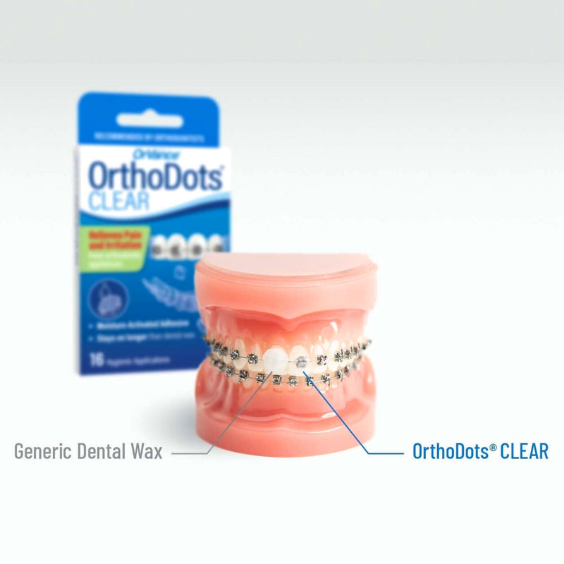ORVANCE Orthodontic Wax, Clear Moisture Activated Braces Wax Alternative for Pain Relief, 72 Count 12 Count (Pack of 6) - BeesActive Australia
