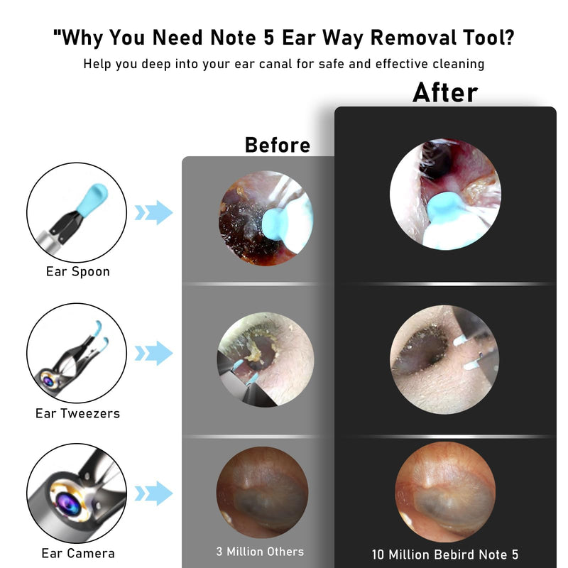 Note5 Ear Wax Removal Kit with Camera,10MP Ear Cleaner Camera Otoscope with Light,Real-time Remote Video with Ear Pick & Tweezers,12 Pcs Ear Scoops for Whole Family Update Ear Wax Tweezers - BeesActive Australia