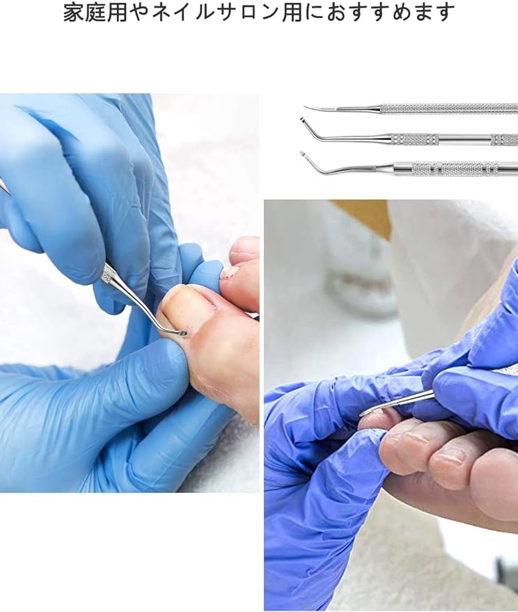 YFFSFDC Nail Scalking Remover, Nail File, Nail Scaler, Nail Lifter, Foot Gap, Winding Nails, Thick Nails, Nail Care, Nail Care, Stainless Steel, Case Included, Set of 3 - BeesActive Australia