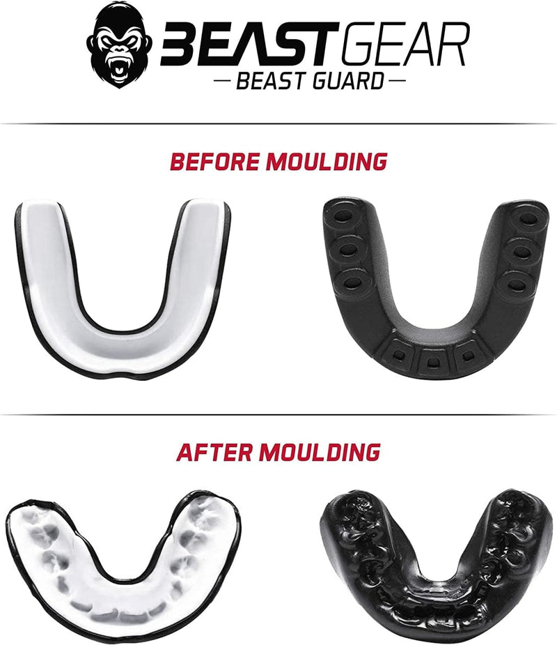 Beast Gear Sports Mouth Guard - Adult and Youth Gum Shield for Boxing, Football, Lacrosse, Basketball, Rugby, MMA - Mouthguard Sports Accessories for Men, Women & Kids - BeesActive Australia