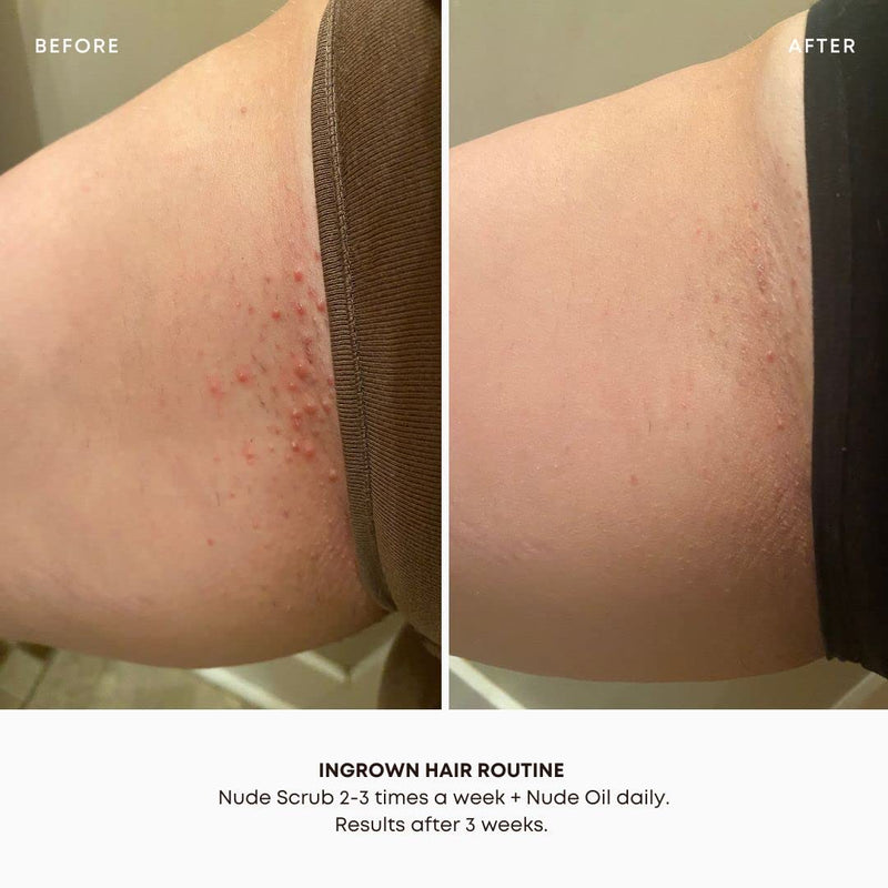 Bushbalm Ingrown Hair and Razor Bumps 2 Step Routine - Moisturize and Soothe - Nude Ingrown Hair Oil (30 ml), Nude Exfoliating Scrub (236 ml) - Nude 2 Piece Set - BeesActive Australia