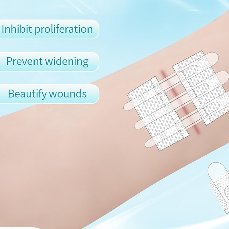 Wound Closure Strips Zip Stitch Sutures Butterfly Bandaids Emergency Laceration Closure Kit for Lacerations Incisions Cuts(6X8CM) 6x8cm