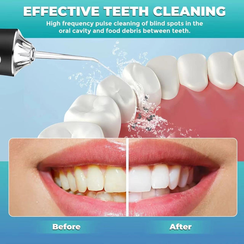 Water Dental Flosser Teeth Pick Portable Cordless Oral Irrigator Rechargeable Travel Irrigation Cleaner 3 Modes 4 Jets IPX7 Waterproof Electric (Black) Black