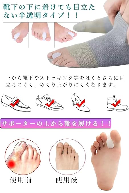 Toe supporter [Just pinch it between your fingers] Spreads out easily Washable with water Easy to put on and take off Unisex - BeesActive Australia