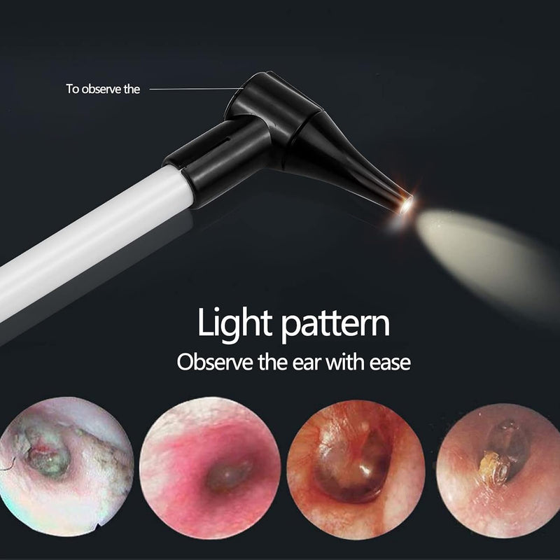 Slimline Stainless Pocket Otoscope, Handheld Ear Scope Otoscope with Soft LED Light & 7 Specula Tips for Kids Adults Pets Animals - BeesActive Australia