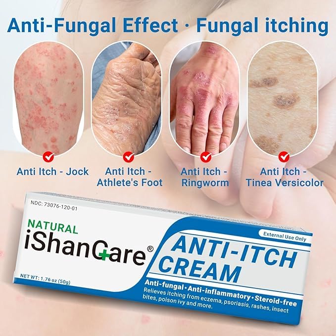 ishancare Anti Itch Soothing Cream Extra Strength Skin Itch Relief Ointment, for Full Body Itching Caused by Seasonal Changes, Dermatitis, Eczema, Rash, Psoriasis, Hives, Bites, Poison Ivy, 1.76 oz 1.76 Ounce (Pack of 1)