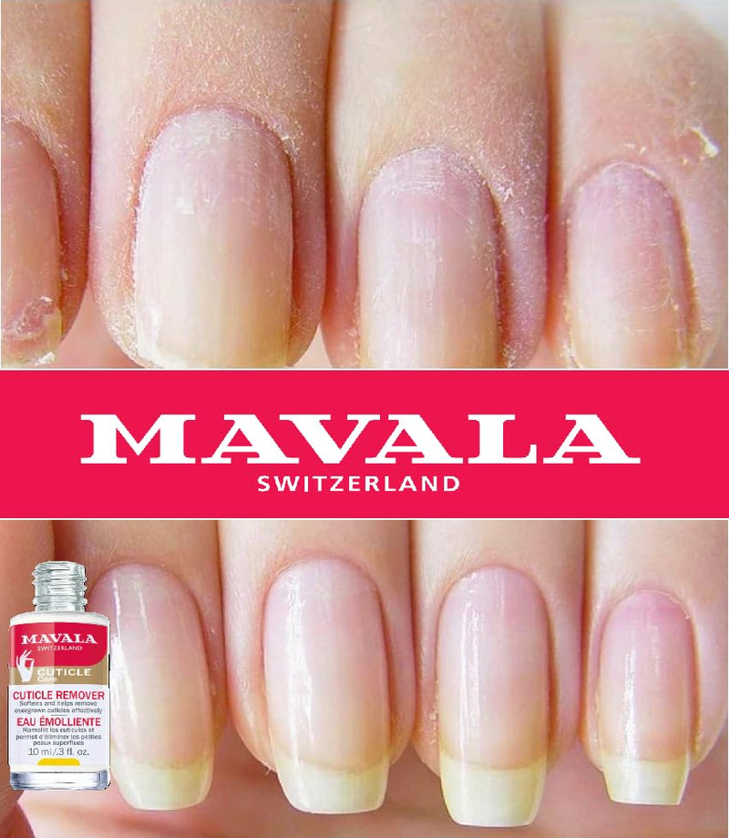 MAVALA Cuticle Remover for Overgrown Cuticles, 0.3-ounce | Softens Cuticles | Fast Acting | Form Neat Nail Contour | Gently remove Dead Cells from Cuticle
