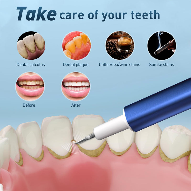 Dental Calculus Remover, Ultrasonic dental calculus remover for Teeth Cleaning with 4 Replaceable Heads and 3 Adjustable Modes - BeesActive Australia