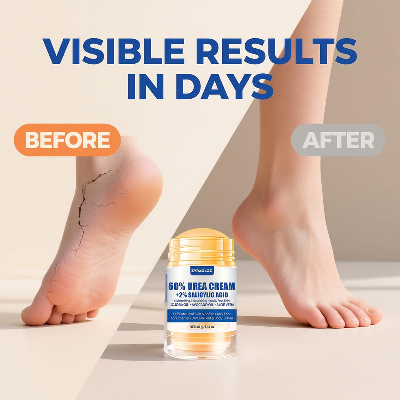 Urea Cream Stick 60% plus 2% Salicylic Acid, 2PCS Maximum Strength Urea Cream for Feet, Foot Lotion Stick for Cracked Heels, Dry Hands & Rough Knees, Callus Remover & Skin Softener, Soften Dead Skin 1.4 Ounce (Pack of 2)