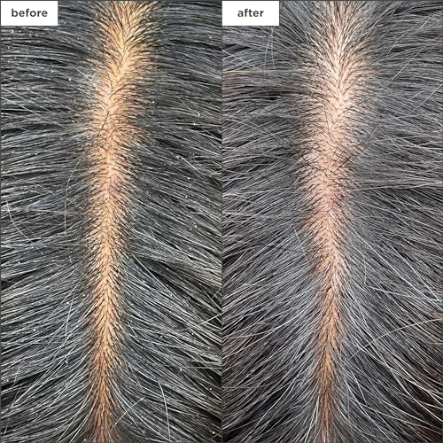 Briogeo Scalp Revival Charcoal + Tea Tree Cooling Hydration Scalp Mask