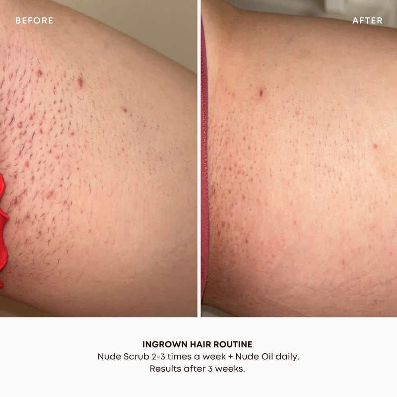 Bushbalm Ingrown Hair and Razor Bumps 2 Step Routine - Moisturize and Soothe - Nude Ingrown Hair Oil (30 ml), Nude Exfoliating Scrub (236 ml) - Nude 2 Piece Set - BeesActive Australia