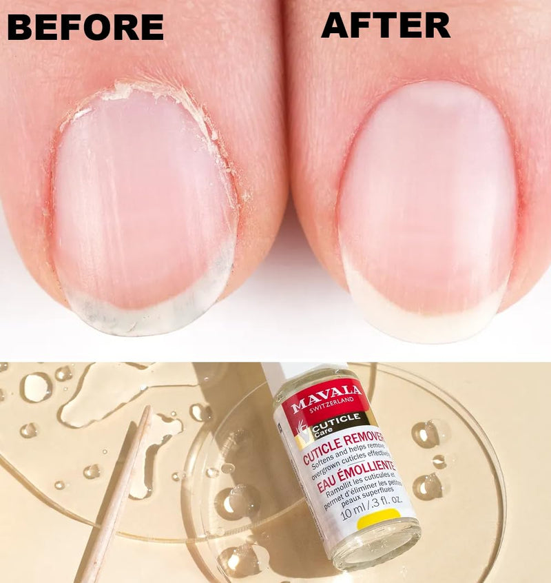 MAVALA Cuticle Remover for Overgrown Cuticles, 0.3-ounce | Softens Cuticles | Fast Acting | Form Neat Nail Contour | Gently remove Dead Cells from Cuticle