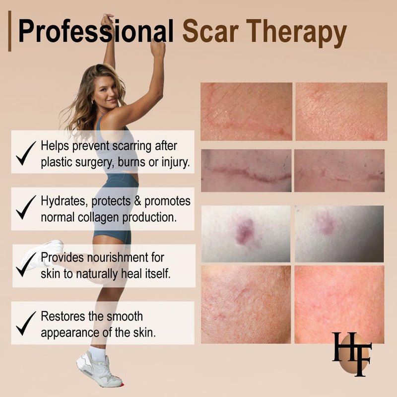 HealFast The Original Scar Cream for Stretch Marks – Soothes, Nourishes and Refreshes Skin – Using Ovasome Technology with Allantoin & Alpha LIpoic Acid – 2 Oz/ 60 ml - BeesActive Australia