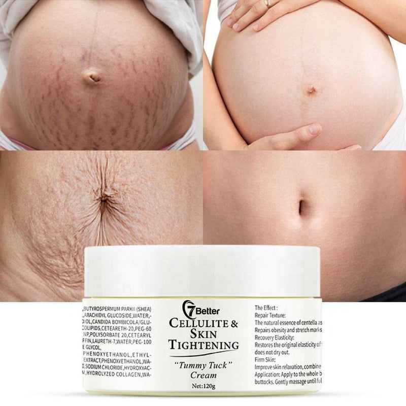 Stretch Marks and Scars Removal Cream for Pregnancy - Scars Repair, Abdominal Firming, and Gentle Stretch Marks Eradication Skincare Body - BeesActive Australia