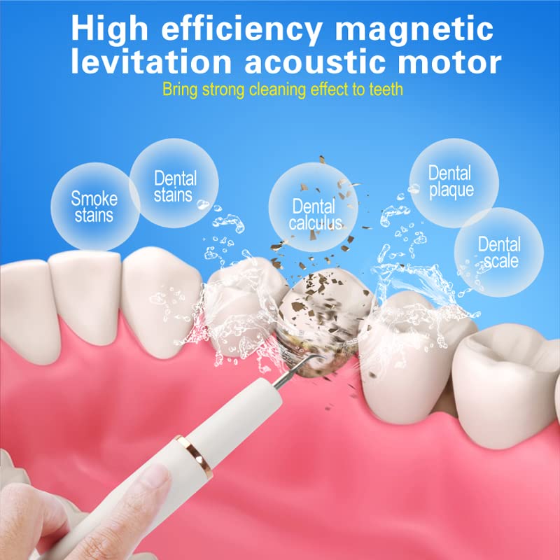 Professional Plaque Remover for Teeth, Teeth Cleaner Tool with Intelligent and Secure Sensor Technology, 4 Replaceable Heads 5 Modes, OLED Light & Oral Mirror, Rechargeable Teeth Cleaning Kit For Home - BeesActive Australia