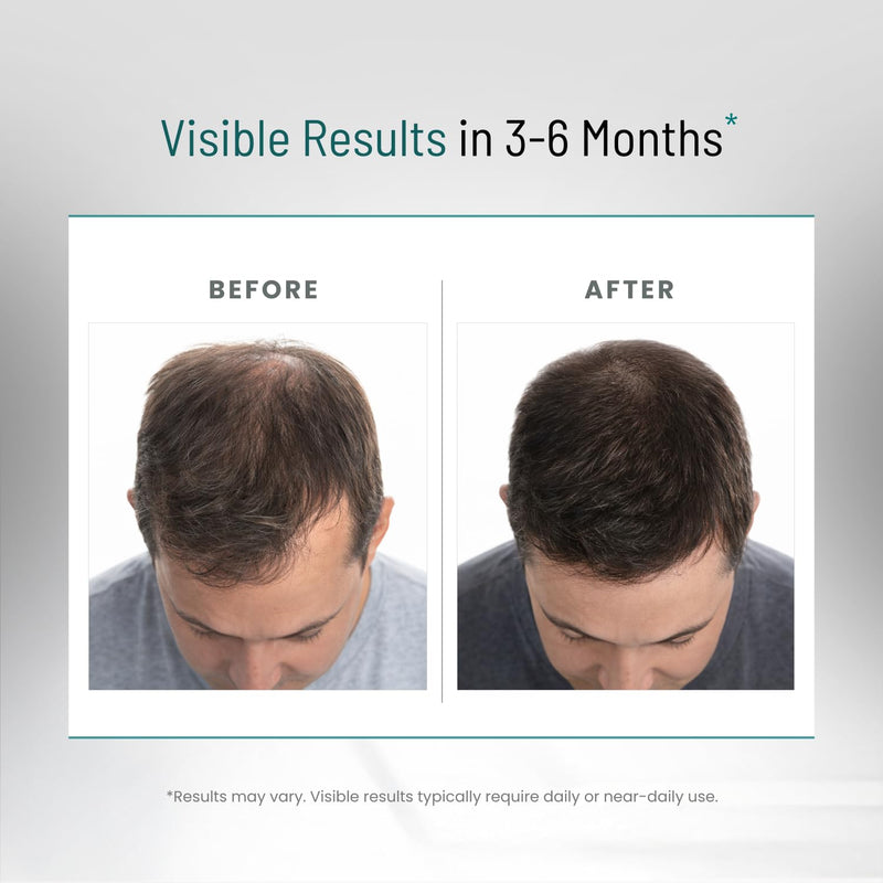 DHT Blocker for Men | Ultra Potent Hair Growth Formula | Saw Palmetto, Biotin, Pumpkin Seed, Herbal Extracts | Natural Hair Loss Supplements | Hair Regrowth Vitamins | Made in the USA | 90 Capsules