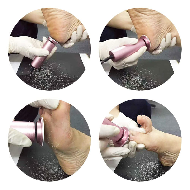 Dr.Pedi Electric Callus Remover for Feet Speed Adjustable Electric Foot File with 60pcs Replacement Sandpaper Discs Pro Pedicure Foot Filer Dead Dry Hard Skin Calluses Foot Grinder Pink - BeesActive Australia