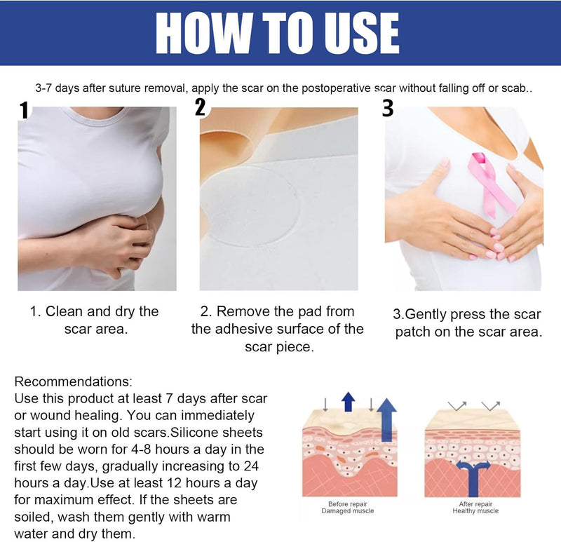 Silicone Scar Sheets for Breast - 8 Pack, Including 4 Areola Soft Strips & 4 Anchor Sheets