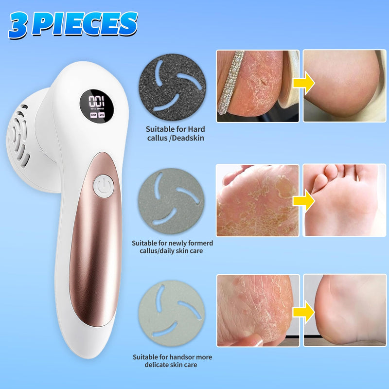 Electric Feet Foot Callus Remover Equipped with A Vacuum System Foot Scrubber 17 in 1 Professional Foot Care Tool Ipx6 Waterproof Rating for Removing Hard Cracks Dryness and Dead Skin (White) White - BeesActive Australia