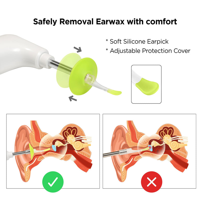 MOBI Otoscope Ear Cleaning Accessory Kit, Compatible with MOBI Smart Otoscope, Great for Earwax Removal. Includes 14 Pieces with Multi-Use Functionality - BeesActive Australia