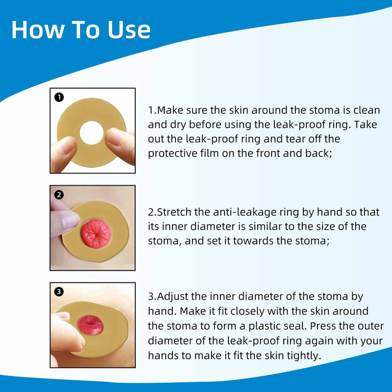 10PCS Ostomy Barrier Rings,Sting Free Moldable Ostomy Rings,Hydrocolloid Skin Extender Rings for colostomy Bags 2MM - BeesActive Australia