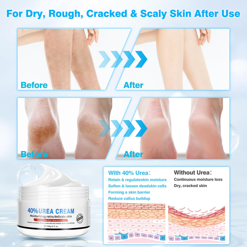Urea Cream 40 Percent for Feet Maximum Strength, with Foot Mask Covers(50 pairs), Foot Cream for Dry Cracked Heels and Feet, Soft Feel Urea Lotion, 3.5 OZ, Foot Files 3.5 Ounce (Pack of 1) File and Foot Mask Covers