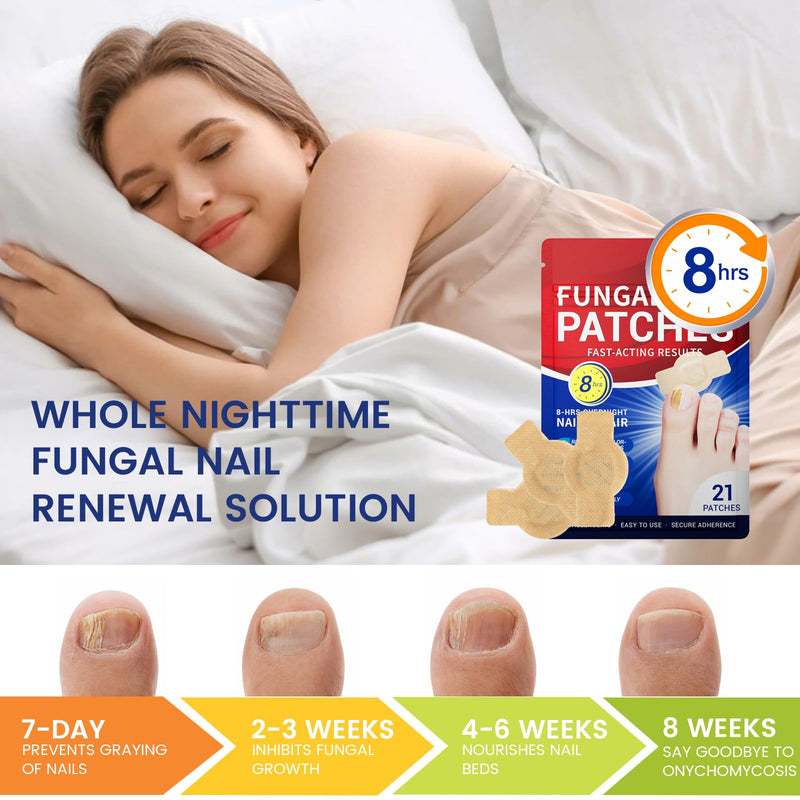 Toenail Fungus Treatment Extra Strength - 42 Pcs Fungal Nail Patches, 8-Hour Firm Adhesion, Nail Repair for Damaged Nails, Overnight Renewal for Men & Women (2 Count (Pack of 21)) 0.88 Ounce (Pack of 2) - BeesActive Australia
