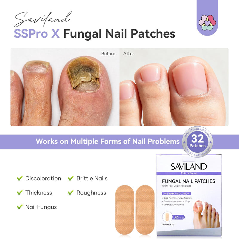 SAVILAND Extra Strength Fungal Nail Patches: 8H Overnight Repair 1% Tolnaftate Toenail Treatment Nighttime Nail Renewal Restores Damaged Nails Discolored Thick Yellow Healthy Appearance 32PCS