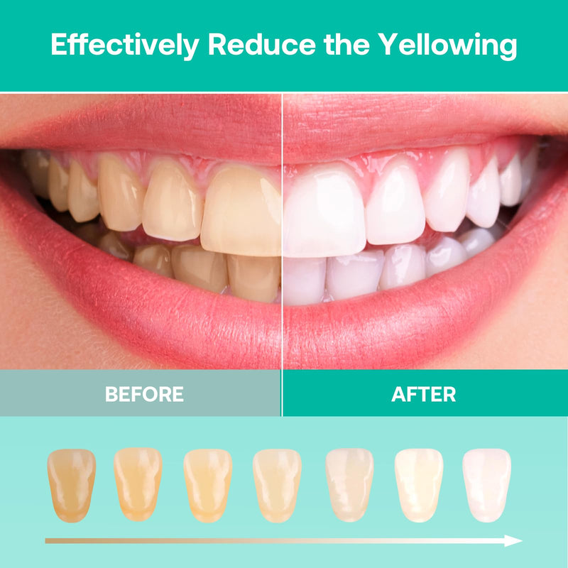 Teeth Whitening Kit, LED Teeth Whitening Light with 6 X 3ml Carbamide Peroxide Teeth Whitening Gel, Included 2 Mouth Trays & Tray Case and Brush, Safe Enamel, Fast and Gentle Teeth Whitening - BeesActive Australia