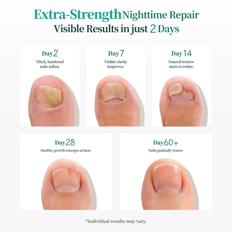 APUREE Fungal Nail Patches Extra Strength: True 1% Tolnaftate | 8H Overnight Fungal Toe Nail Treatments | FSA-HSA | Repair For Discolored Yellow Brittle Damage Nails| Revives Natural look| 64 Patch