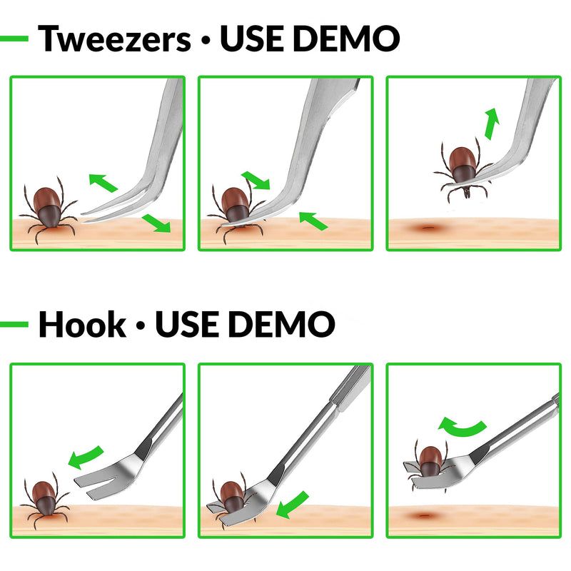 MYDAISY 2 in 1 metal tick tweezers with case, stainless steel tick tweezers for humans, dogs, cats, horses - human tick tweezers - tick tweezers for dogs - cat tick tweezers - tick tweezers - BeesActive Australia