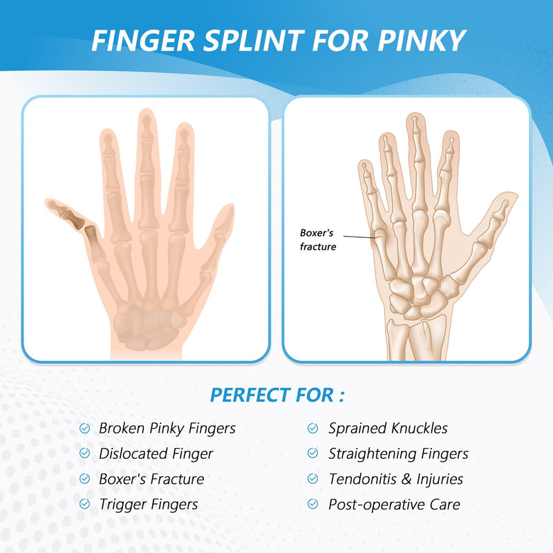 Pinky Finger Splint, Finger Splint for Pinky, Broken Finger, Trigger Finger, Metacarpal Splint Hand Brace, Little Finger Brace for Tendonnitis, Pain Relief, Fits for Left & Right Hand(M) M Mesh