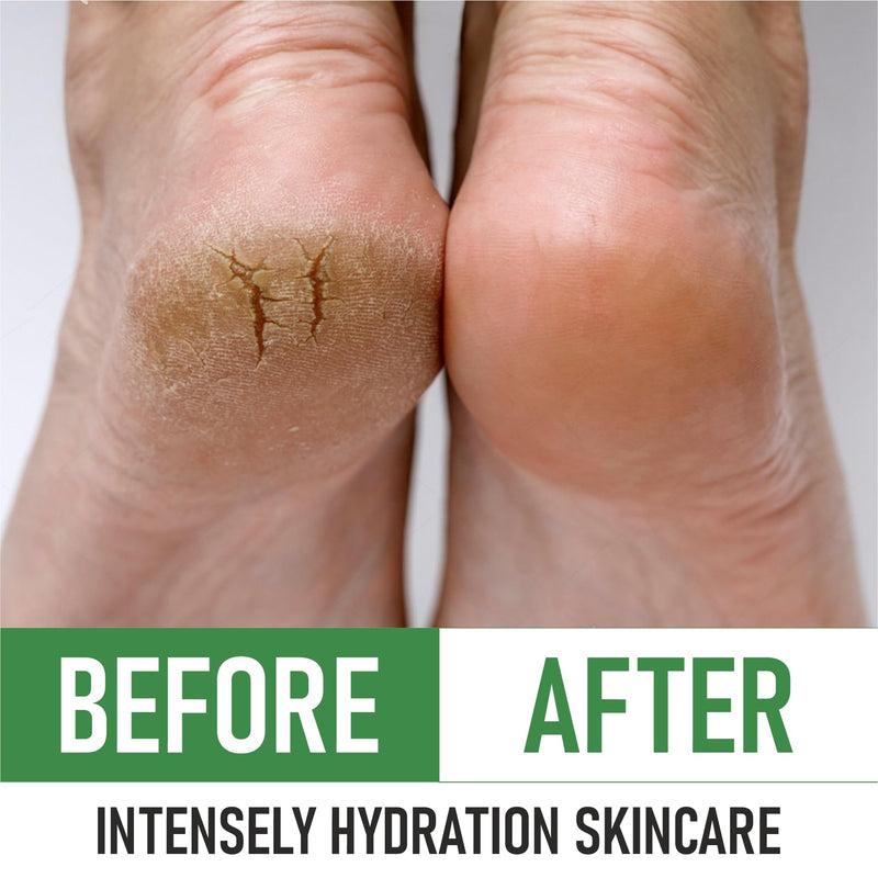 PurOrganica Urea 40% Foot Cream – Made in USA, Dermatologist Tested, Intensive Repair for Dry, Cracked Heels, Calluses & Rough Feet, Professional Strength Exfoliating & Moisturizing Cream - Pack of 3 4 Ounce (Pack of 3) - BeesActive Australia