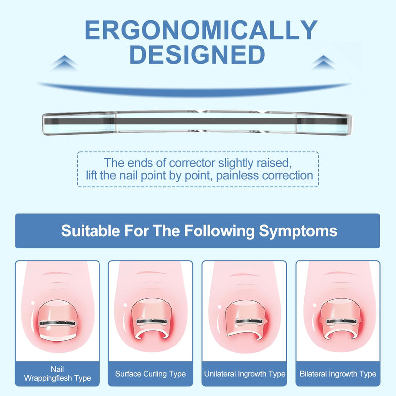 12Pcs Ingrown Toenail Corrector Strips for Curved Toenail Quick Relief,4 Multi-Sizes Ingrown Toenail Treatment Relief Tools Kit for Home Use