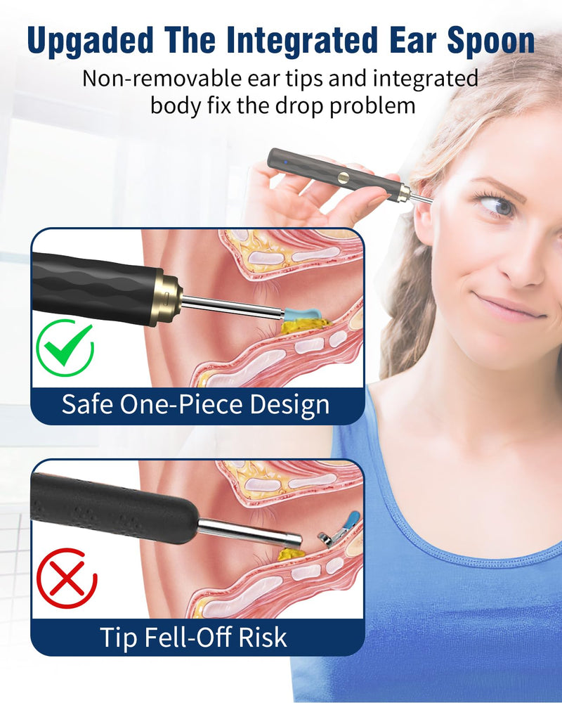 Ear Wax Removal Camera, Kekoy Ear Cleaner 1296P HD Camera, Ear Cleaning Kit with 8pcs Ear Set, Wireless WiFi Otoscope with 6 Lights, Rechargeable Earwax Removal Tool Kit for Adult & Kid（Bright White) Bright White - BeesActive Australia