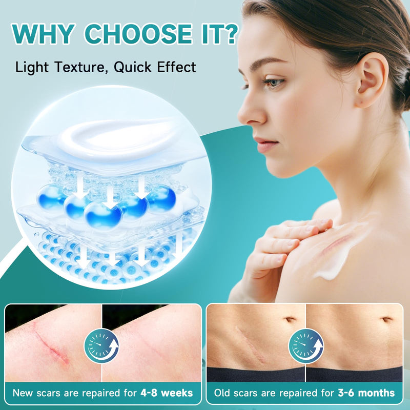 Pumkot Advanced Scar Cream, Silicone Gel for Scars, Professional Scar Removal Cream for Surgical Scars, Stretch Marks, Old and New Scars 1.7 oz(50ml) - BeesActive Australia