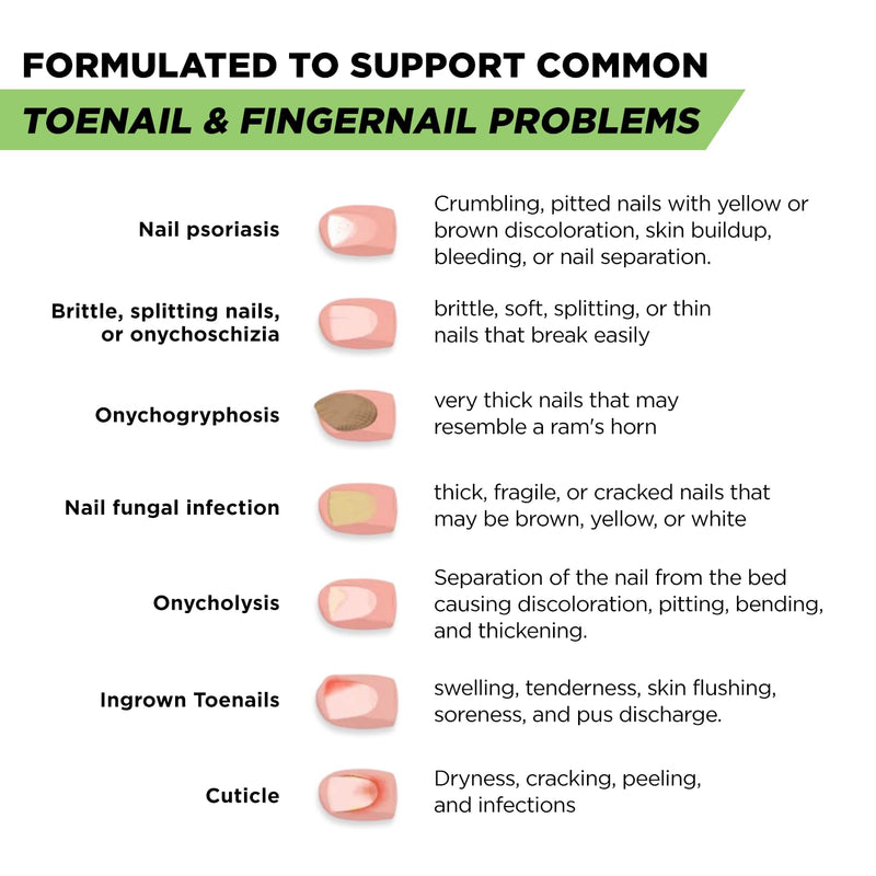 Footcure Antifungal Nail Treatment Pen – Extra Strength Toenail Fungus Treatment, 25% Undecylenic Acid for Toenails & Fingernails, Nail Fungus Repair Pen with Tea Tree & Oregano Oil, Made in USA 0.1 Fl Oz (Pack of 2)