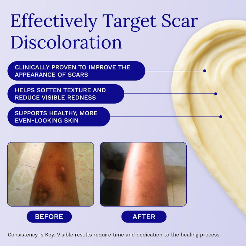 Rejuvaskin RejuvaSil Silicone Scar Gel, Scar Treatment for Surgical Scars, Burns, Keloids, Acne Scars on Face & Body, 30ml 30 ml (Pack of 1) - BeesActive Australia