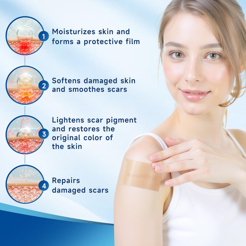 Silicone Scar Sheets, Silicone Scar Tape(1.8‚Äù x 157‚Äù Roll 4M), Silicone Scar Sheets for Surgical Scars, Keloid Bump Removal, Stretch Marks Removal, C-Section, Burn et Brown
