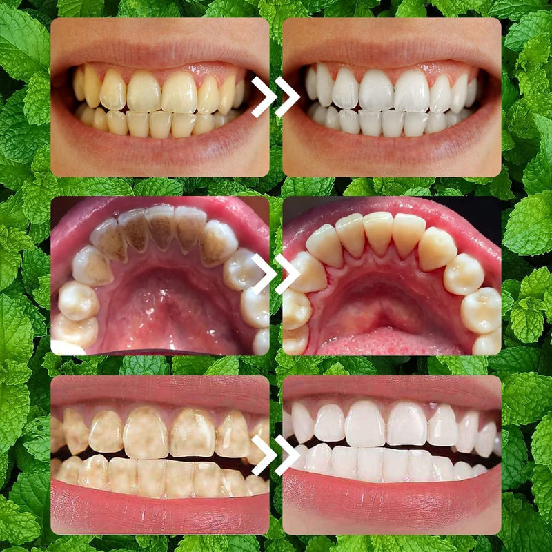 2PCS Purple Teeth Restoration Mineral Powder, Mineral Tooth Powder, Dental Restoration Mineral Effective in Strengthening Teeth and Gums for Daily Use