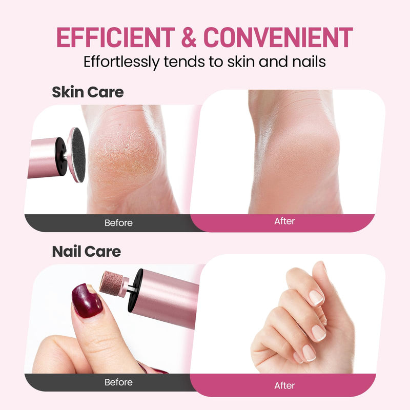 Electric Foot Callus Remover, 2 in 1 | 6 Speed Adjustable Foot File Nail Grinder with Sandpaper Disks, Professional Pedicure Tool for Feet Dead Skin, Self Care Gifts for Women Mom Lover Friends (Pink) - BeesActive Australia