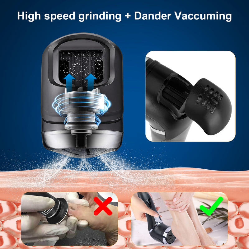 Electric Foot Callus Remover, IPX7 Waterproof Pedicure Kit Rechargeable Calloused Feet Remover Tool with LCD Display, 2-Speed Dual Motors for Efficient Exfoliation of Dead Skin on Feet - BeesActive Australia