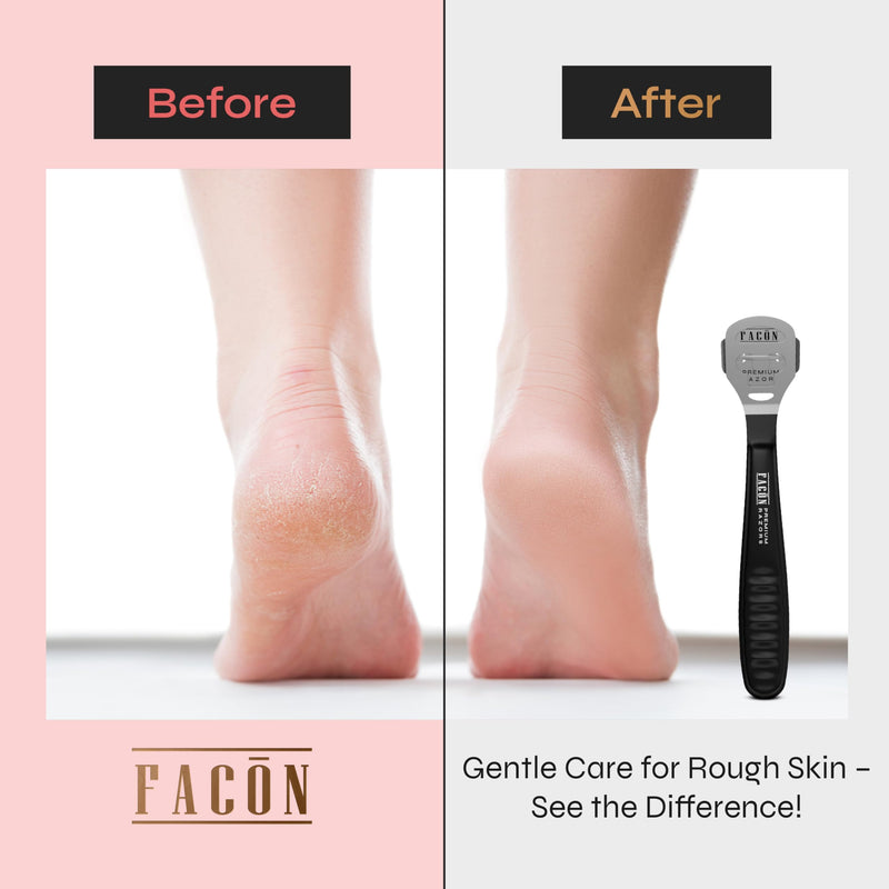 Fac√≥n Professional Callus Shaver Remover with 50 Blades, Pedicure Razor for Feet & Hands, Foot Razor for Callus Removal, Callus Blade Remover, Corn Shaver, Surgical Grade Premium Stainless Steel Tool Black