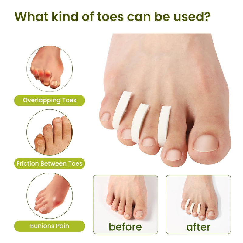 Bukihome 44-Pack Foam Toe Separators – Soft & Breathable Toe Spacers for Women & men, Help Align Overlapping Toes, Relieve Friction & Pressure, Ideal for Daily Comfort