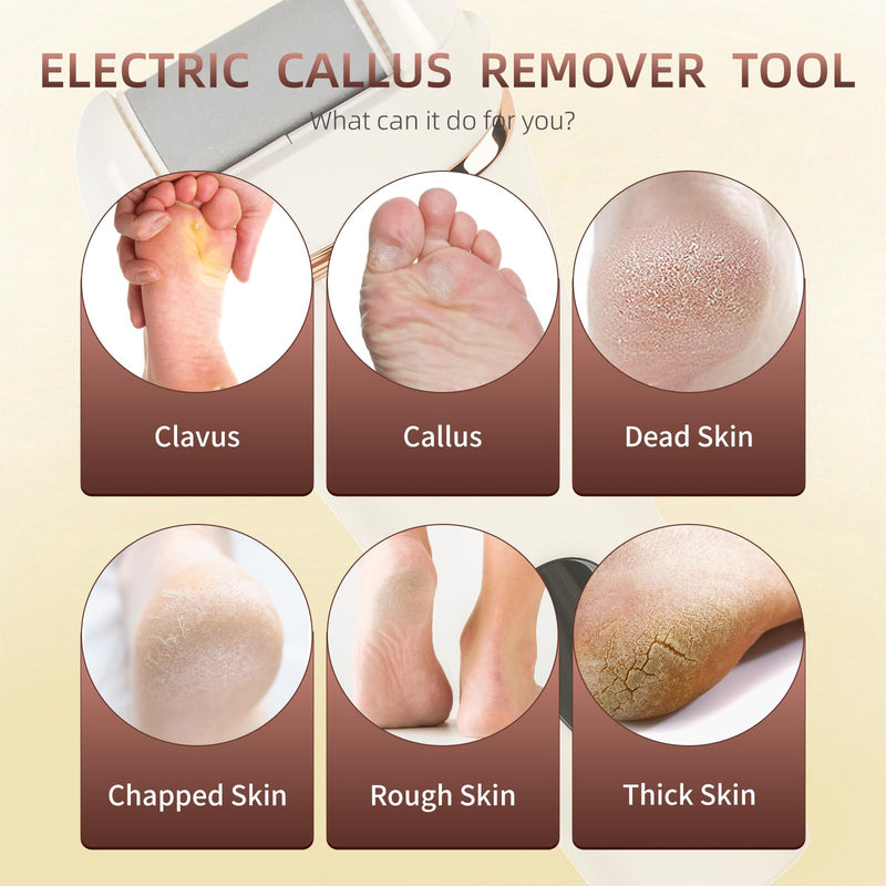 Electric Callus Remover for Feet, 17-in-1 Professional Pedicure Kit, Foot Scrubber Electric Foot File for Hard Cracked Dry Dead Skin, 3 Rollers, 2 Speed, Battery Display White-0001 1.0 - BeesActive Australia
