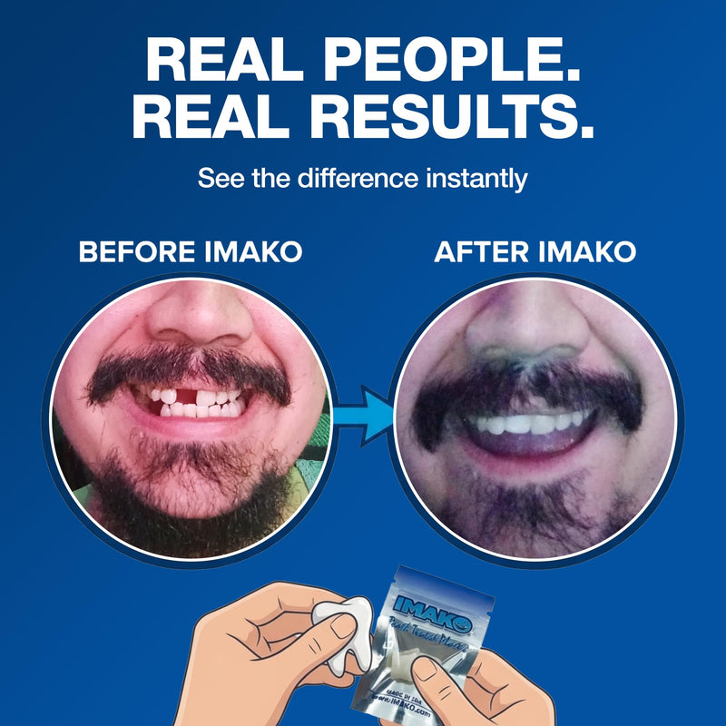 Imako Tooth Tinted Plastic - Natural Color - Temporary Tooth - Made in USA 1 Count (Pack of 1)