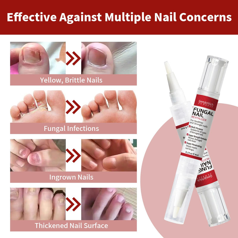 Toenail Fungus Treatment Extra Strength Nail Repair Pen, Repair Damaged Nails Yellow, Discolored, Thick and Ingrown Nails, Fungus Pen for Toenails and Fingernails with Tea Tree Oil, 3 Pens & 3 Files