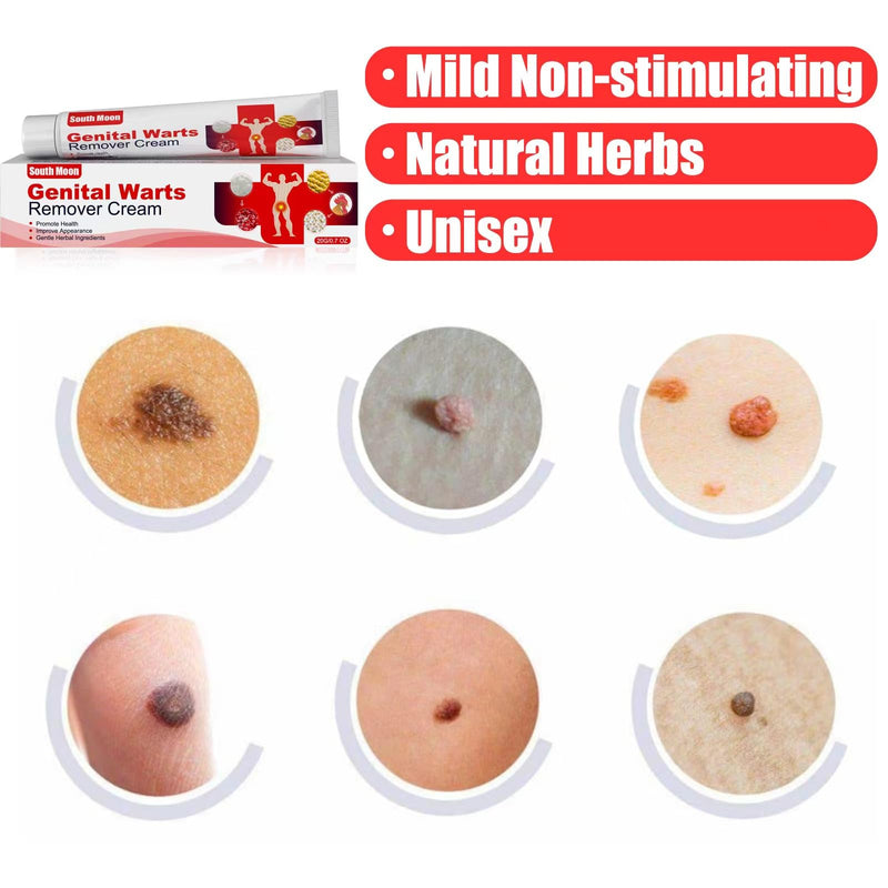 Wart Remover Freeze Off - Wart Cream for Genital Warts, Genital Wart Freeze Off Wart Removal.1(PCS).1 White - BeesActive Australia