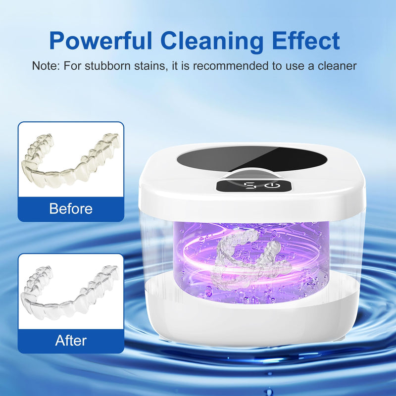 Professional Ultrasonic Retainer Cleaner Retainer Cleaning Machine - 45kHz Ultrasonic Cleaning, Suitable for Denture Mouth Guard Aligner Dental Trays M - BeesActive Australia
